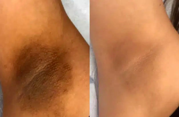 Real Results!