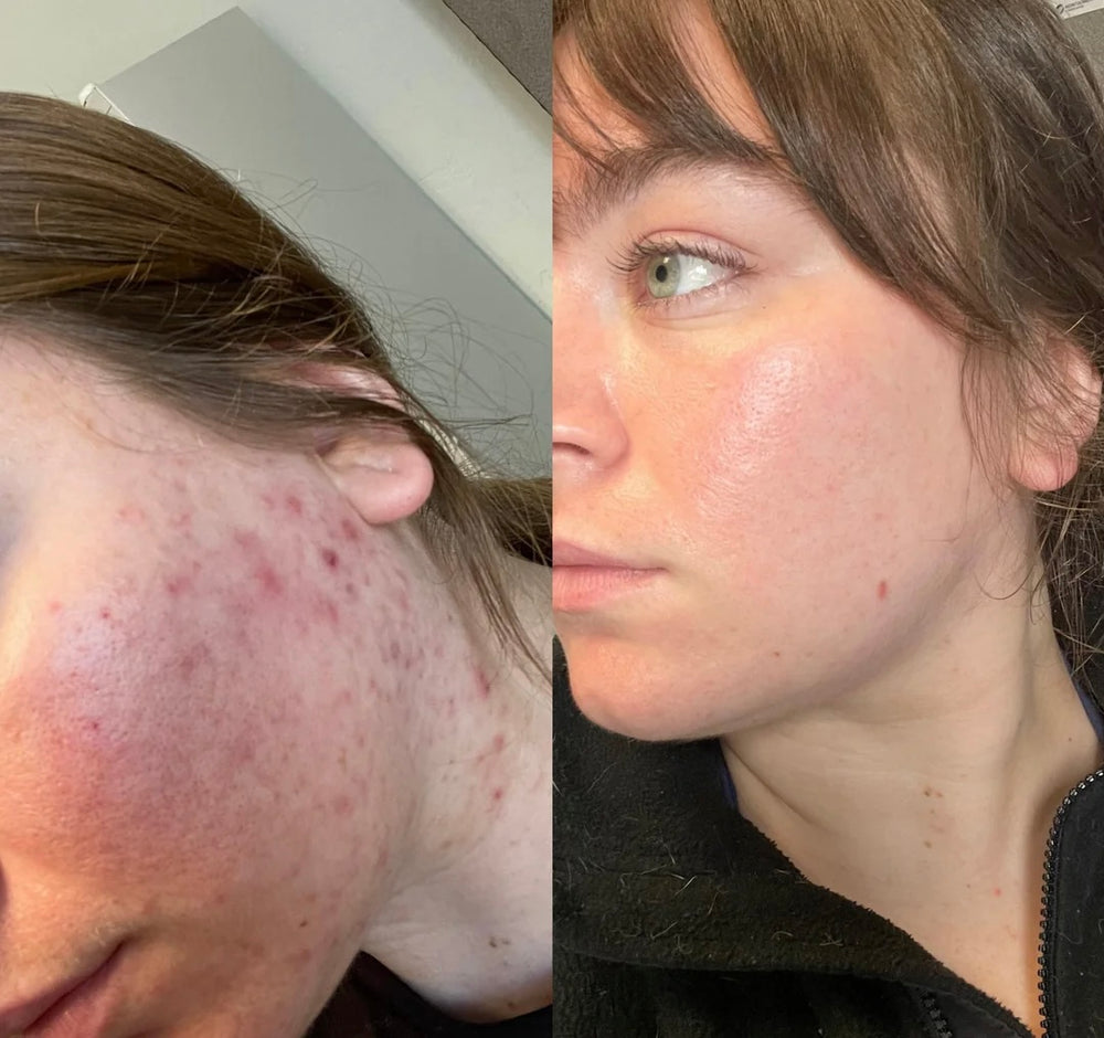 Real Results!