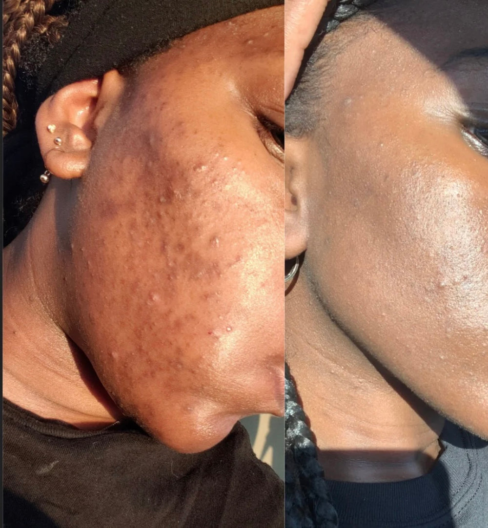Real Results!
